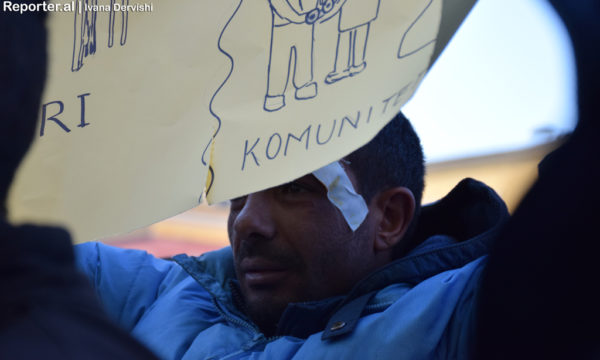 Shkëlqim Qerimi, 34 vjeç, baba i tre fëmijëve, tregoi në protestë plagët për të cilat ai akuzoi si shkaktarë oficerë të policisë. Foto: Ivana Dervishi/BIRN